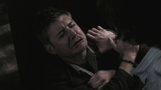 Top Dean Winchester Gruesome Injuries